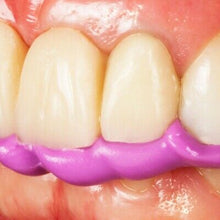 Cargar imagen en el visor de la galería, OCCLUFAST ROCK MONO 2 X 50ML